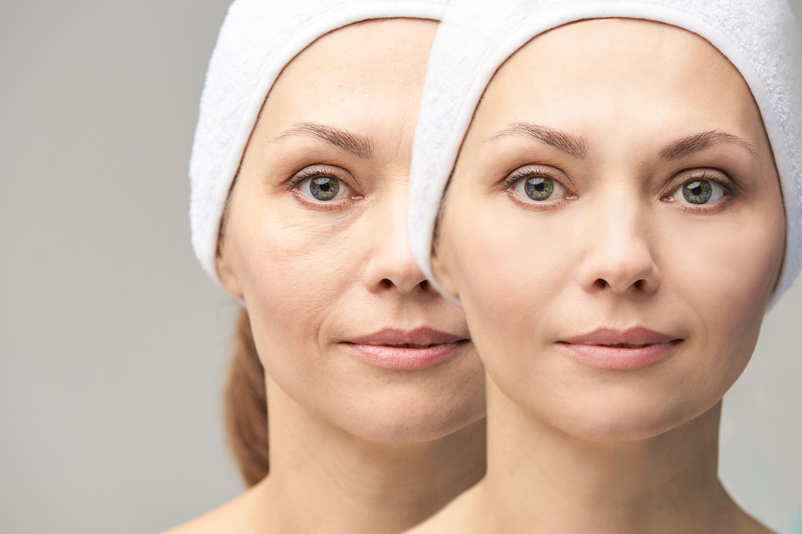 Neurotoxin Treatments | Arcanum Aesthetics | Tampa, Florida