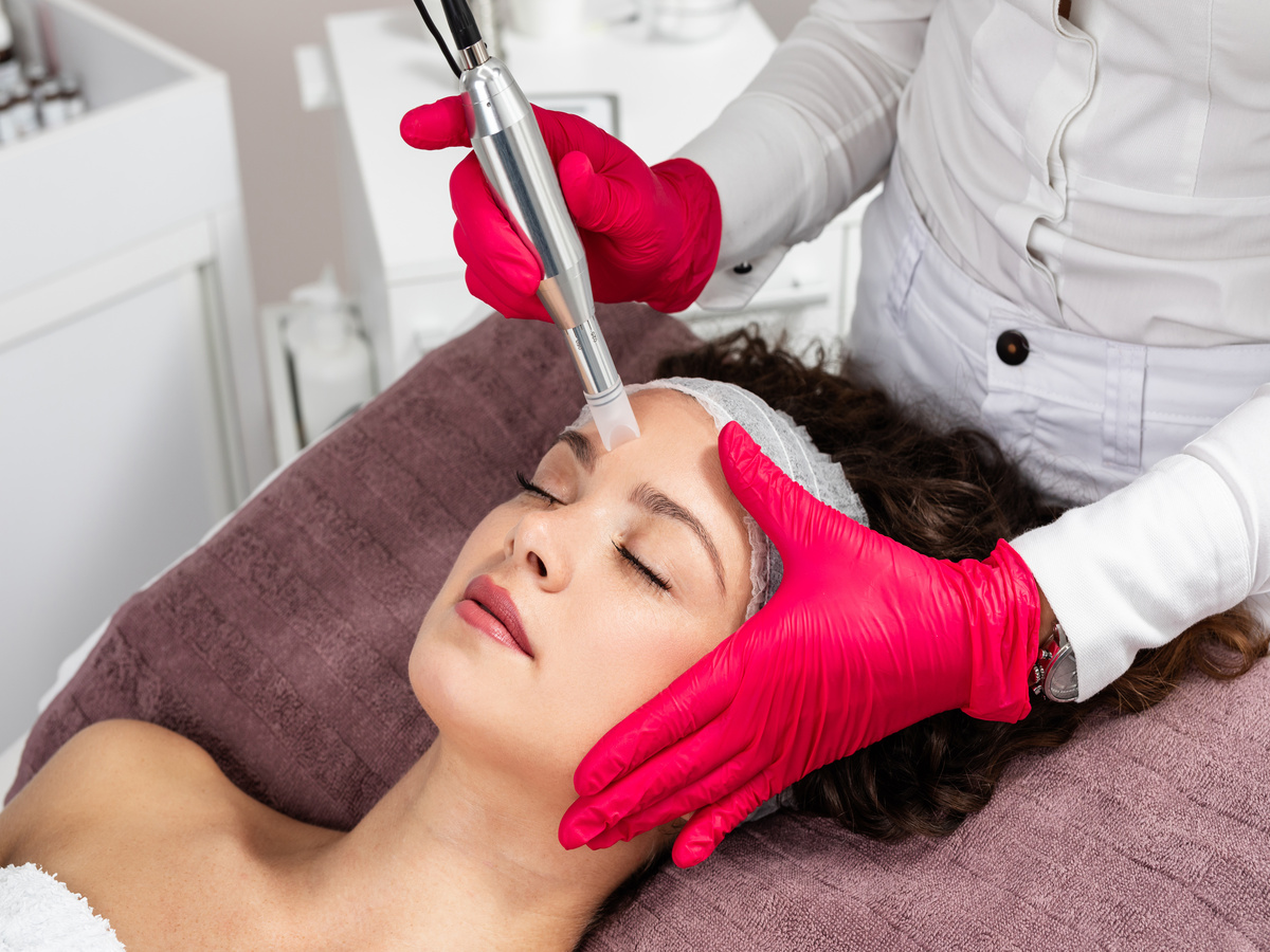 Microneedling Treatment | Arcanum Aesthetics | Tampa, Florida