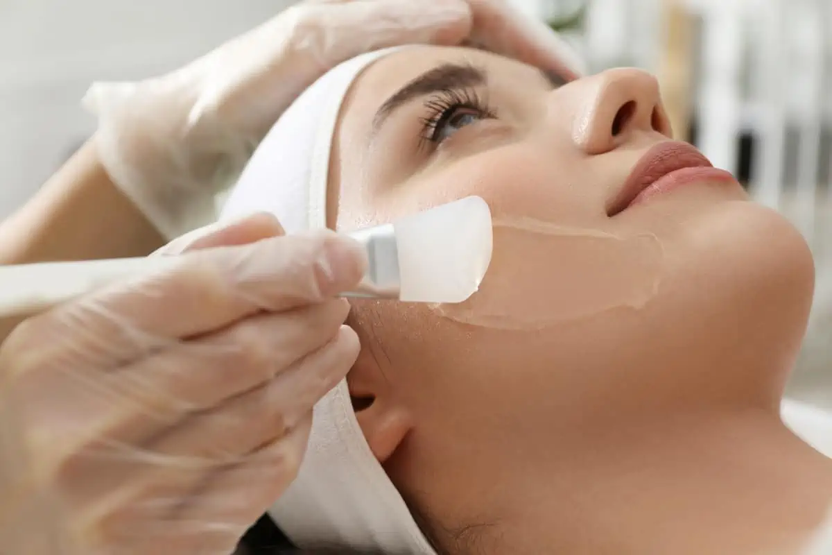 Chemical Peel treatment on face