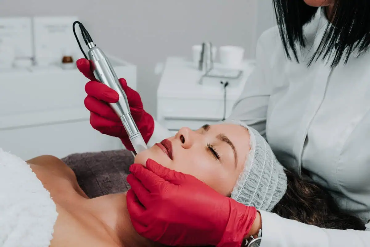 Microneedling by Arcanum Aesthetics in Tampa FL